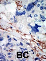 PAB2929 - DYRK2