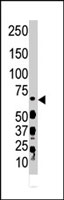 PAB2930 - DYRK3