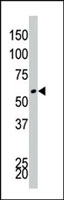 PAB2931 - DYRK4