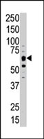 PAB2933 - DYRK1B