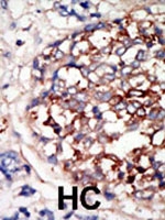 PAB2933 - DYRK1B