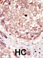 PAB2938 - HIPK3 / FIST / ANPK
