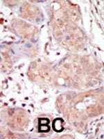 PAB2941 - MAK