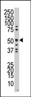 PAB2942 - RAGE