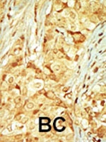 PAB2942 - RAGE