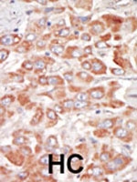 PAB2943 - STK23