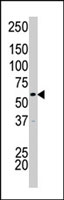 PAB2947 - CDK17 / PCTK2