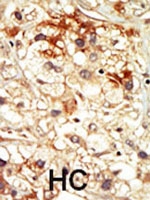 PAB2947 - CDK17 / PCTK2