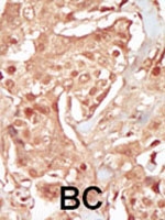 PAB2948 - CDK18 / PCTK3