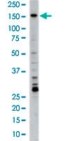 PAB2951 - PRPF4B