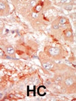 PAB2951 - PRPF4B