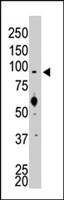 PAB2952 - SRPK1