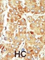 PAB2952 - SRPK1