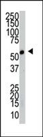 PAB2953 - SRPK2