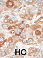 PAB2953 - SRPK2