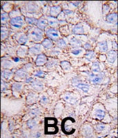 PAB2954 - MAPK15