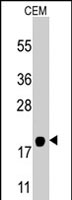 PAB2955 - NAP2 / PPBP / CXCL7