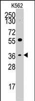 PAB2956 - Thrombopoietin
