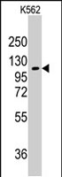 PAB2957 - AARS