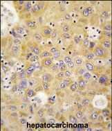 PAB2957 - AARS