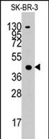 PAB2959 - ACAT1 / MAT