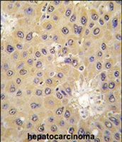 PAB2959 - ACAT1 / MAT
