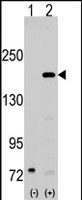 PAB2970 - NCOA1