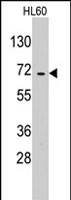 PAB2973 - EARS2