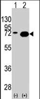 PAB2974 - Heat shock protein 70 / HSP70