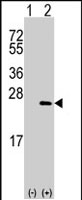 PAB2976 - RAC1