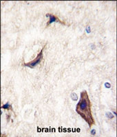 PAB2980 - RASGRF1