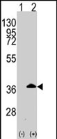 PAB2987 - Apolipoprotein E / Apo E