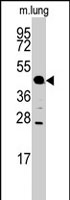 PAB2990 - ACPP / Prostatic acid phosphatase