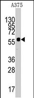 PAB2991 - Kremen protein 1