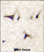 PAB2992 - DAAM2