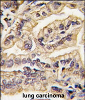 PAB3000 - CD115