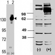 PAB3000 - CD115