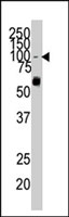 PAB3001 - EPHA1