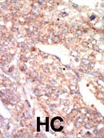 PAB3001 - EPHA1