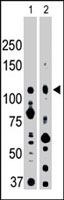 PAB3003 - EPHA2 / ECK