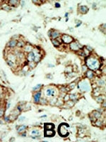 PAB3003 - EPHA2 / ECK