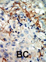 PAB3005 - EPHA3