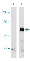 PAB3006 - EPHA3