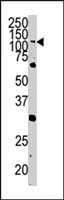 PAB3007 - EPHA4