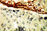 PAB3007 - EPHA4