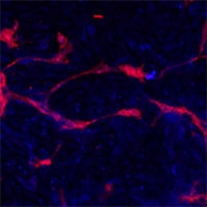 PAB3007 - EPHA4