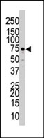 PAB3009 - EPHA5