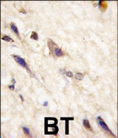 PAB3009 - EPHA5