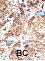 PAB3018 - EPHB1