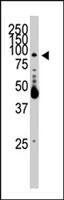 PAB3019 - EPHB2